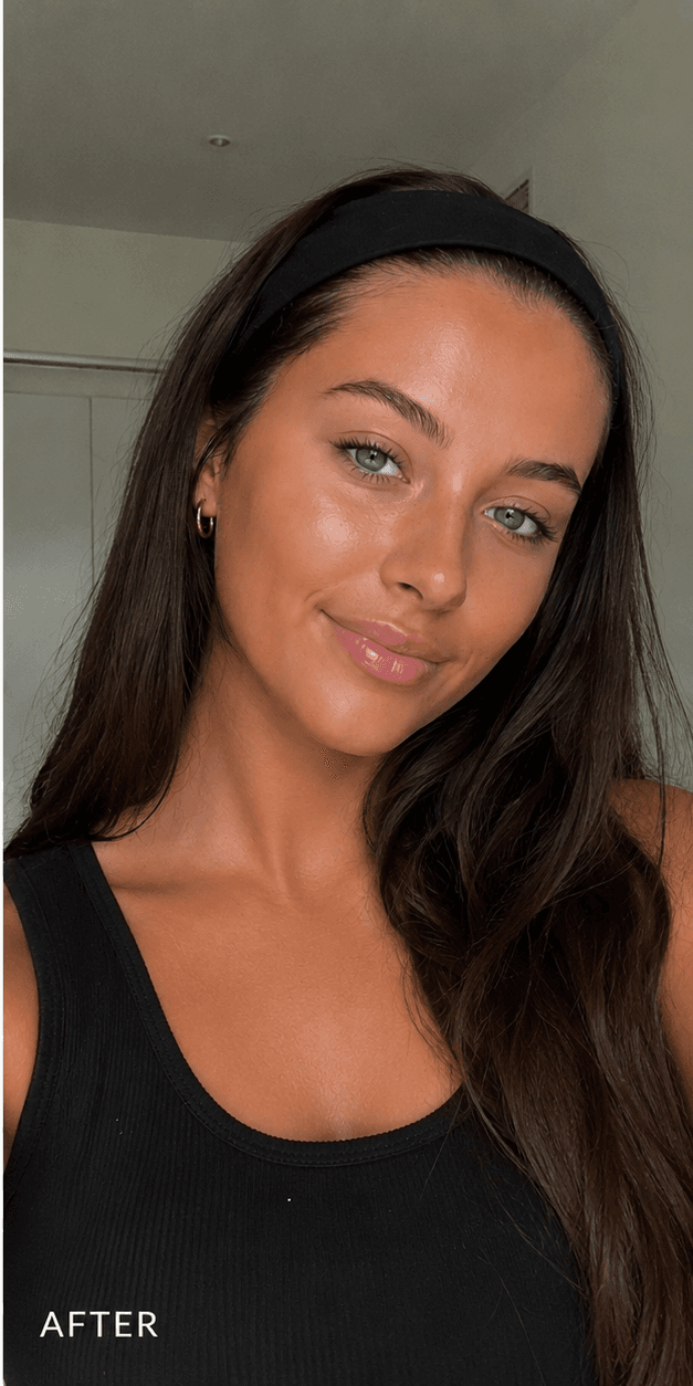 Self-tan after — face after Face Tan Drops Dark — even soft glow, freckles still readable, no orange