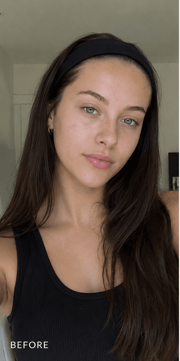 Self-tan before — face without Face Tan Drops — natural skin tone, freckles visible