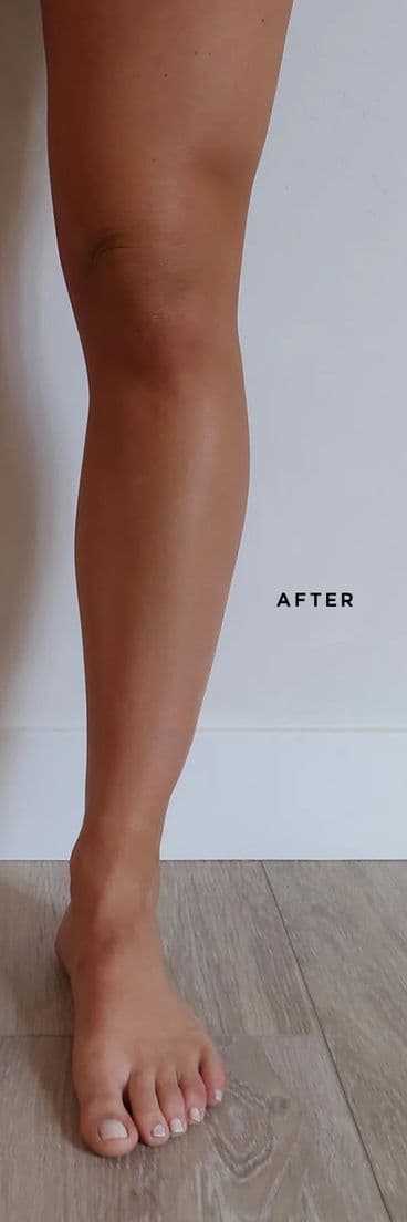 Self-tan after — fair-neutral legs after the medium mousse, even soft bronze, six-hour develop